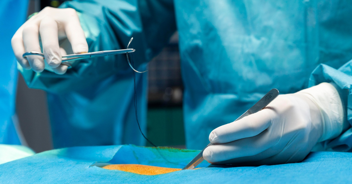 Suture Size Chart Ultimate Guide to Choosing the Right Surgical Threa