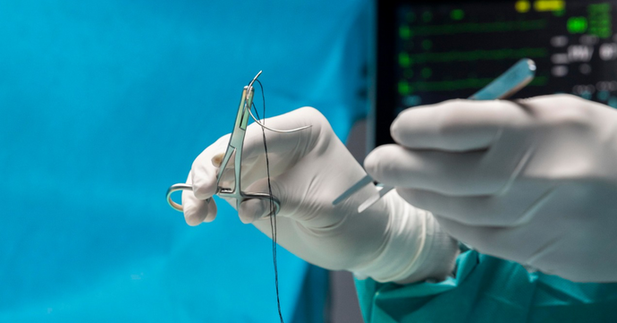 How Long Does It Take for Stitches to Heal?