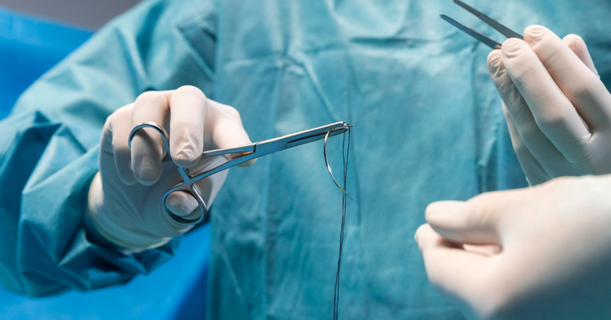 How to Know If You Need Stitches: 10 Clear Signs & What to Do Next