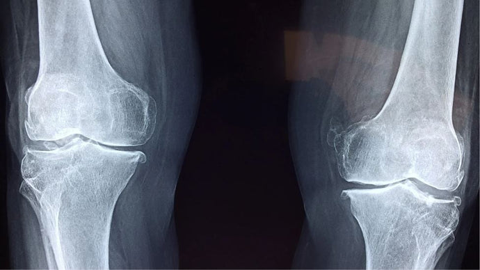 Best Practices for Suturing in Orthopedic Surgery: Mastering the Art of Precision and Healing